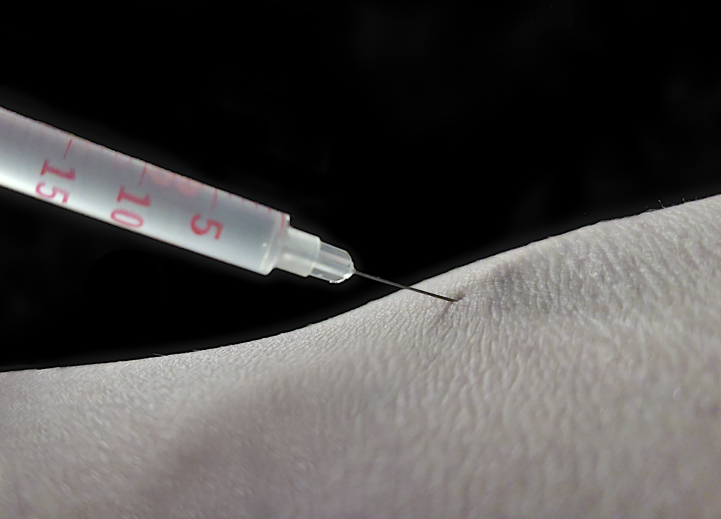 insulin syringe lighly poking at the median cubital vein